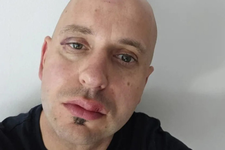 Pretučen gradonačelnik Ribnice