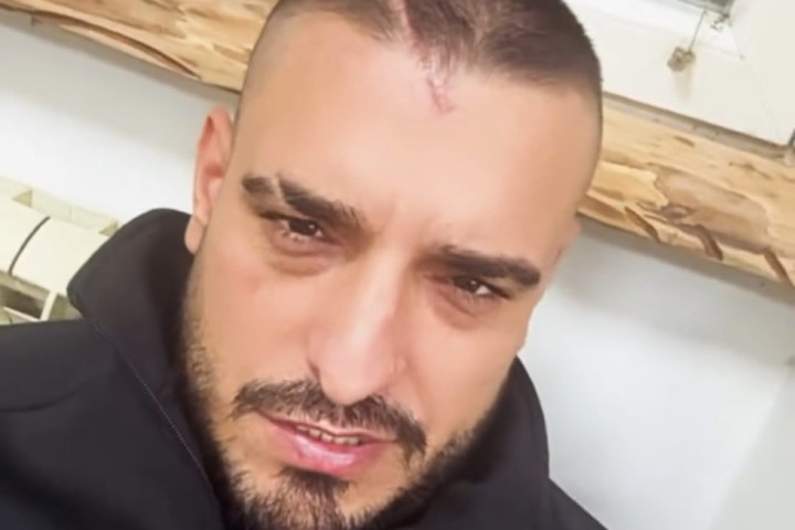 Darko Lazić tvrdi da nije povređen i da se oseća dobro, oglasio se na mrežama