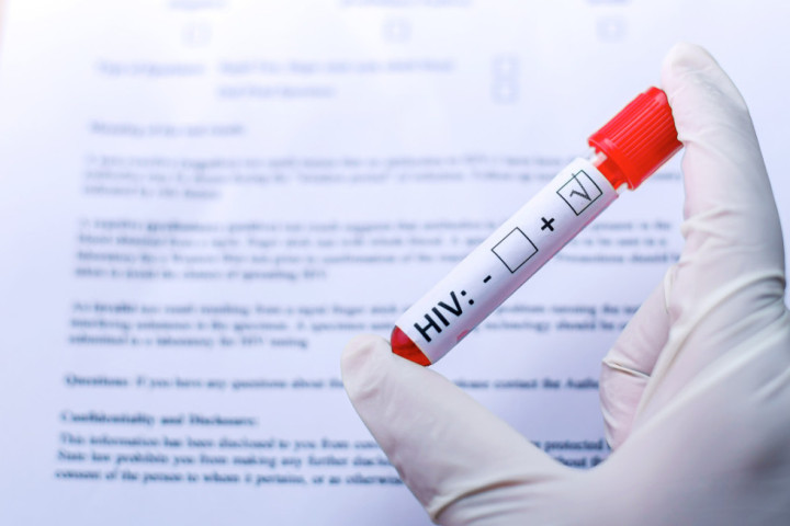 Besplatno i anonimno testiranje na HIV: Savremena terapija čini virus nezaraznim, ali samo ako se na vreme otkrije